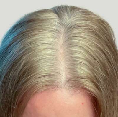 After After 12 Weeks -